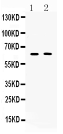 1 - Anti-TUB 1 Picoband Antibody ABO10266