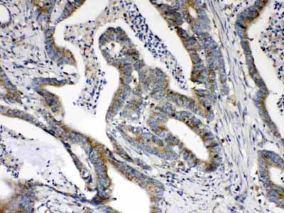 2 - Anti-HSD17B4 Picoband Antibody ABO10268