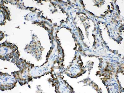 2 - Anti-HSD17B4 Picoband Antibody ABO10268