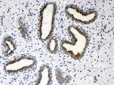 2 - Anti-HSD17B4 Picoband Antibody ABO10268