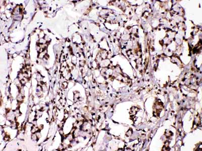 2 - Anti-Islet 1 Picoband Antibody ABO10271