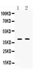 1 - Anti-Islet 1 Picoband Antibody ABO10271