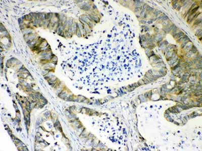2 - Anti-AKR1B10 Picoband Antibody ABO10273