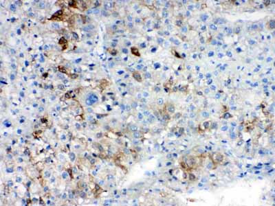 2 - Anti-AKR1B10 Picoband Antibody ABO10273
