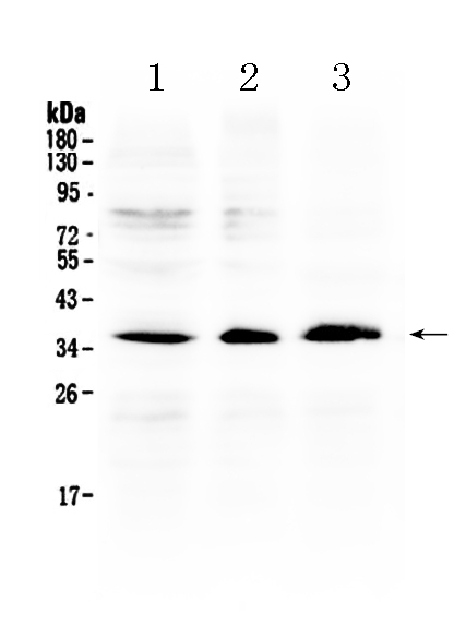 1 - Anti-AKR1B10 Picoband Antibody ABO10273