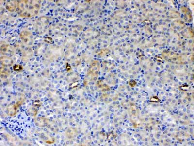 2 - Anti-ALDH1A3 Picoband Antibody ABO10276