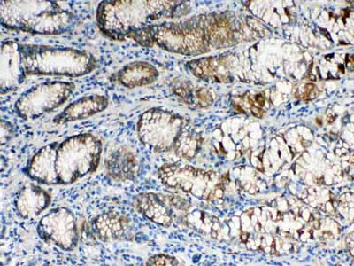 2 - Anti-ALDH1A3 Picoband Antibody ABO10276