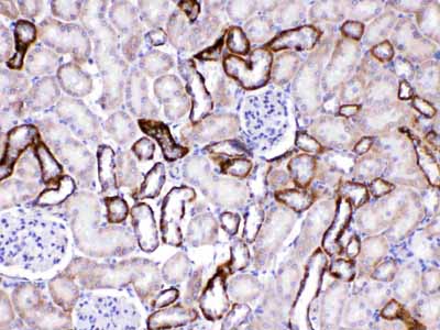 2 - Anti-GAD65 Picoband Antibody ABO10278