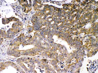 2 - Anti-GAD65 Picoband Antibody ABO10278