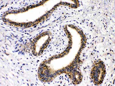 2 - Anti-GAD65 Picoband Antibody ABO10278