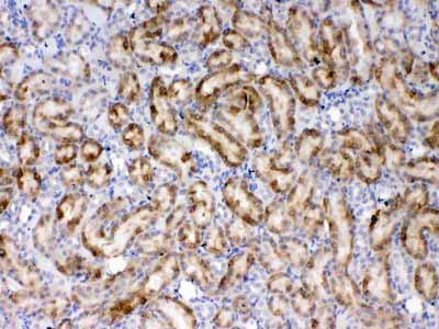 2 - Anti-Thrombopoietin Picoband Antibody ABO10281