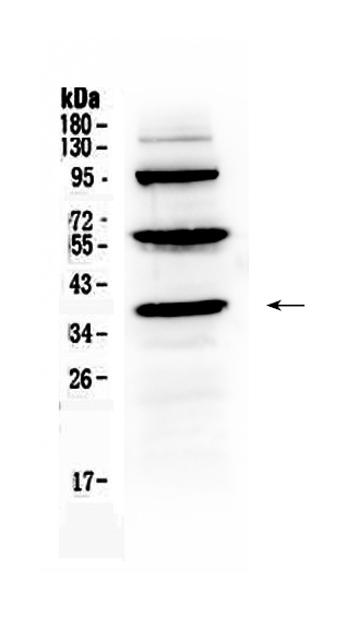 1 - Anti-Thrombopoietin Picoband Antibody ABO10281