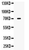 1 - Anti-IL12RB1 Picoband Antibody ABO10287
