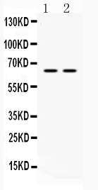1 - Anti-hnRNP L Picoband Antibody ABO10295