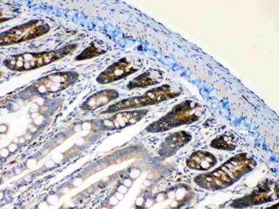 2 - Anti-RanBP1 Picoband Antibody ABO10300