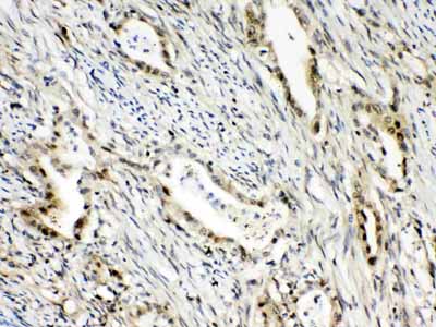 2 - Anti-RanBP1 Picoband Antibody ABO10300
