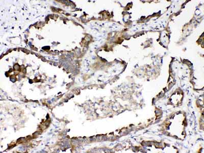 2 - Anti-RanBP1 Picoband Antibody ABO10300