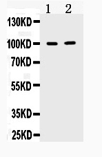 1 - Anti-TACC1 Picoband Antibody ABO10302