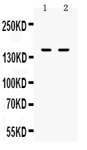 1 - Anti-CD11a Picoband Antibody ABO10306