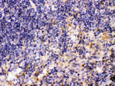2 - Anti-MMP11 Picoband Antibody ABO10308