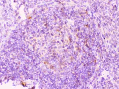 2 - Anti-MMP11 Picoband Antibody ABO10308