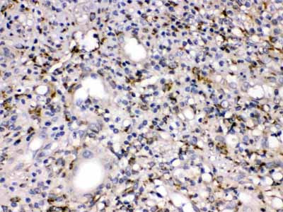 2 - Anti-MMP11 Picoband Antibody ABO10308