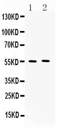 1 - Anti-MMP11 Picoband Antibody ABO10308