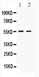 1 - Anti-SLC18A3 Picoband Antibody ABO10313