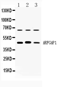 1 - Anti-ARFGAP1 Antibody ABO10314