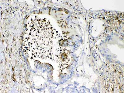 2 - Anti-TMEM107 Picoband Antibody ABO10315
