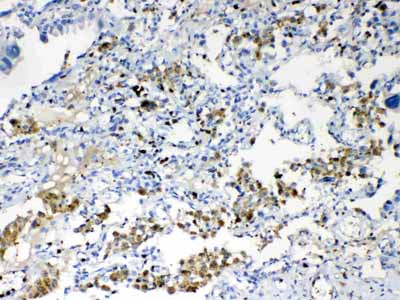 2 - Anti-TMEM107 Picoband Antibody ABO10315