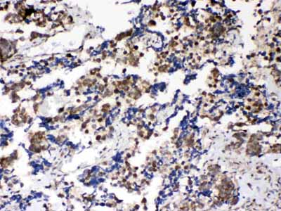 2 - Anti-Musashi 1/Msi1 Picoband Antibody ABO10316