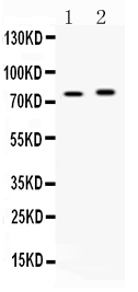 1 - Anti-ACSL5 Picoband Antibody ABO10317