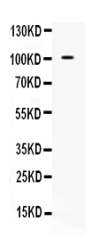 1 - Anti-NARG1 Picoband Antibody ABO10319