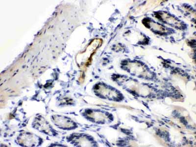 2 - Anti-ANGPTL2 Picoband Antibody ABO10322