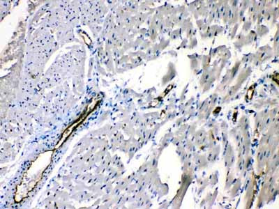 2 - Anti-ANGPTL2 Picoband Antibody ABO10322