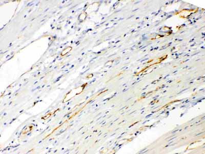 2 - Anti-ANGPTL2 Picoband Antibody ABO10322