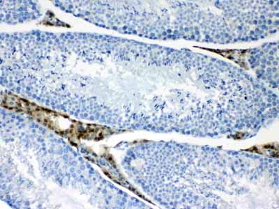 2 - Anti-CPI17 alpha Picoband Antibody ABO10323