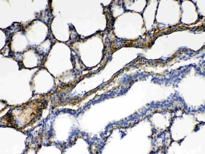 2 - Anti-CPI17 alpha Picoband Antibody ABO10323