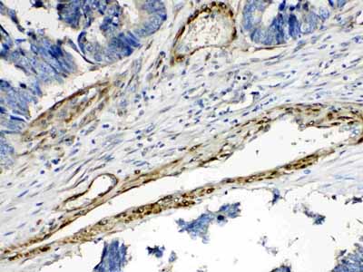 2 - Anti-CPI17 alpha Picoband Antibody ABO10323