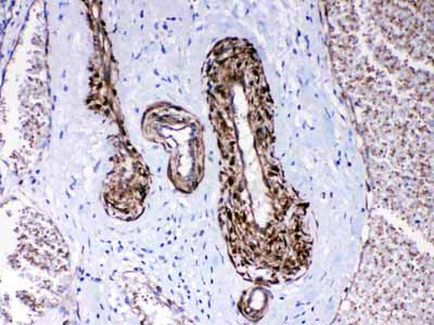 2 - Anti-CPI17 alpha Picoband Antibody ABO10323