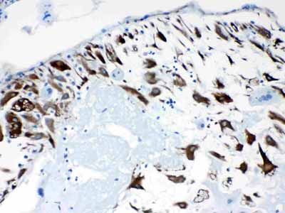 2 - Anti-CPI17 alpha Picoband Antibody ABO10323