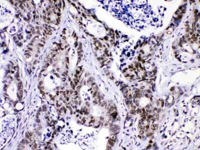 2 - Anti-HnRNP F Picoband Antibody ABO10324