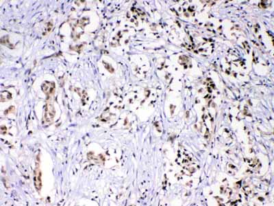 2 - Anti-HnRNP F Picoband Antibody ABO10324