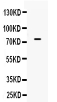 1 - Anti-ACSL3 Picoband Antibody ABO10325