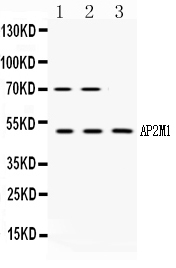 1 - Anti-AP2M1 Picoband Antibody ABO10327