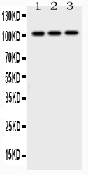 1 - Anti-AP2B1 Picoband Antibody ABO10329
