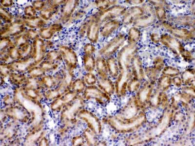 2 - Anti-TIMP4 Picoband Antibody ABO10331