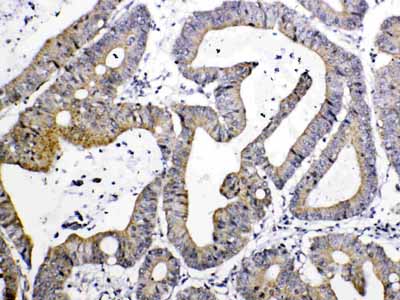 2 - Anti-TIMP4 Picoband Antibody ABO10331