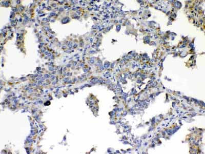 2 - Anti-TIMP4 Picoband Antibody ABO10331